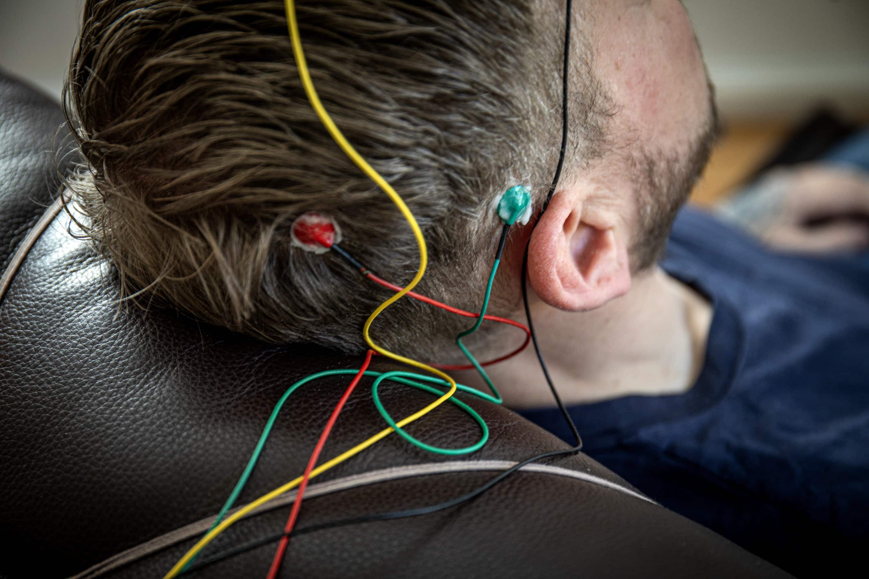 Kan nettet av elektroder løse flokene i hodet?