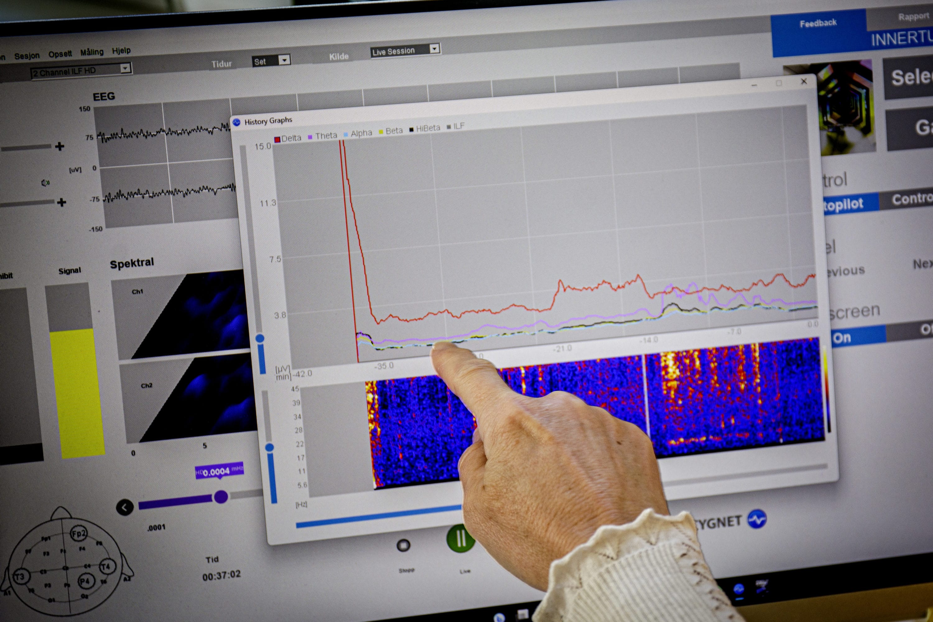Oslo 20230505Reportasje Psykisk Helse NorgeNevrofeedback.